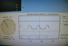 TrueBeam 的 Gating 操作-射频工程师